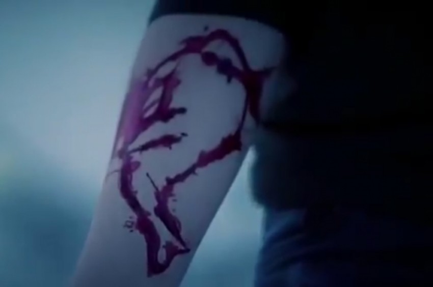 Ako vaše dete ima nešto slično na ruci, to je znak za uzbunu 