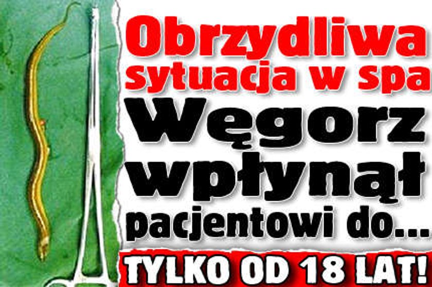 Obrzydliwa sytuacja w spa. Węgorz wpłynął pacjentowi do... Od 18 lat!