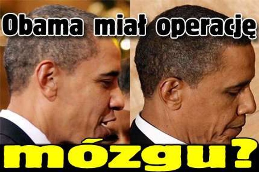 Obama miał operację mózgu?