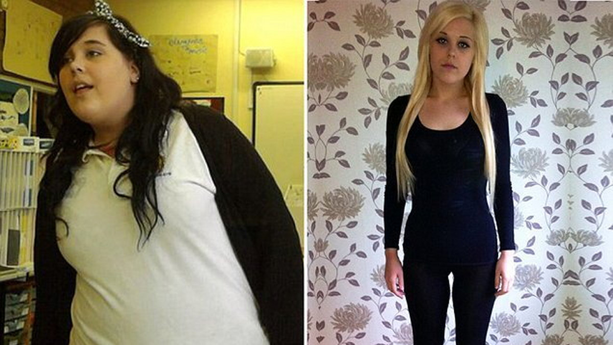 Amelia-Jane Harris ważyła ponad 171 kilogramów, a w 20 miesięcy zrzuciła aż 117 kilogramów. Ta utrata masy ciała nie była jednak wynikiem diety, a skutkiem rzadkiej choroby Crohna, która powoduje przewlekłe problemy z jelitami i układem pokarmowym.
