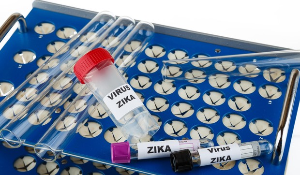 zika profimedia-0273185517