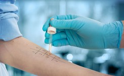 Uczula nas coraz więcej substancji chemicznych. Rośnie liczba alergików