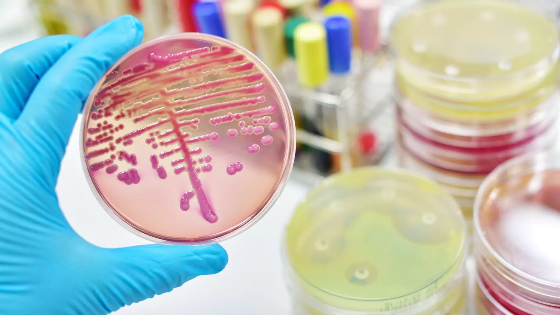 E. coli - czyli zakażenie pałeczką okrężnicy