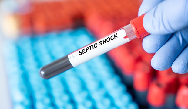 Septički šok je poslednja i najopasnija faza sepse