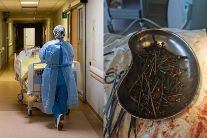 Ennyi csavart és szöget találtak egy exalkoholista férfi gyomrában