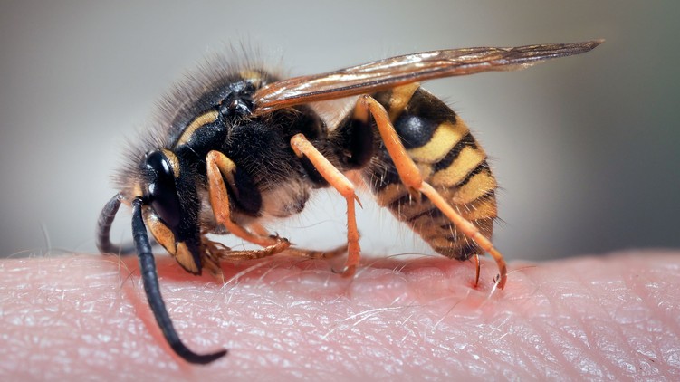 darázscsípés allergia tünetei mennyi idő
