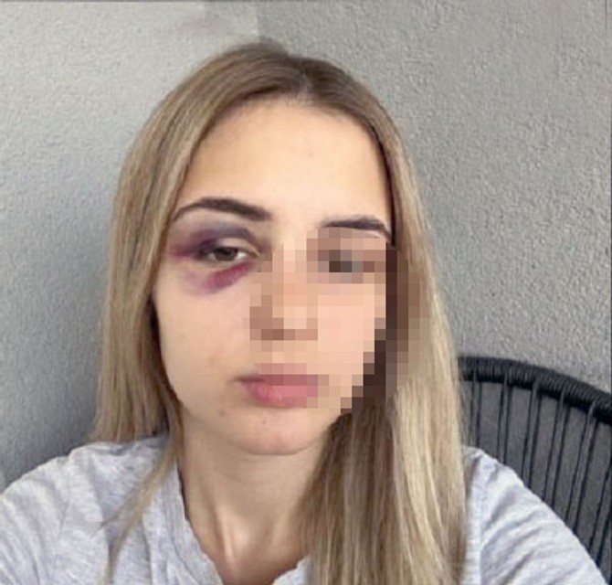 Stravične slike nasilja