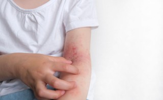 Polska na przedostatnim miejscu rankingu UNICEFu wpływu pestycydów na zdrowie dzieci