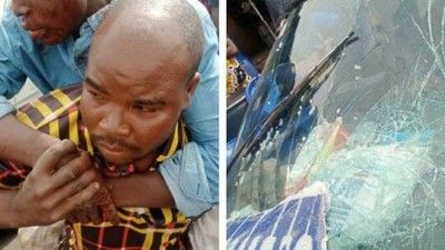 A picture of one side of one of the  accident victims at Adeniji Adele area of Lagos. [PM News]