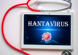 Hantavirus