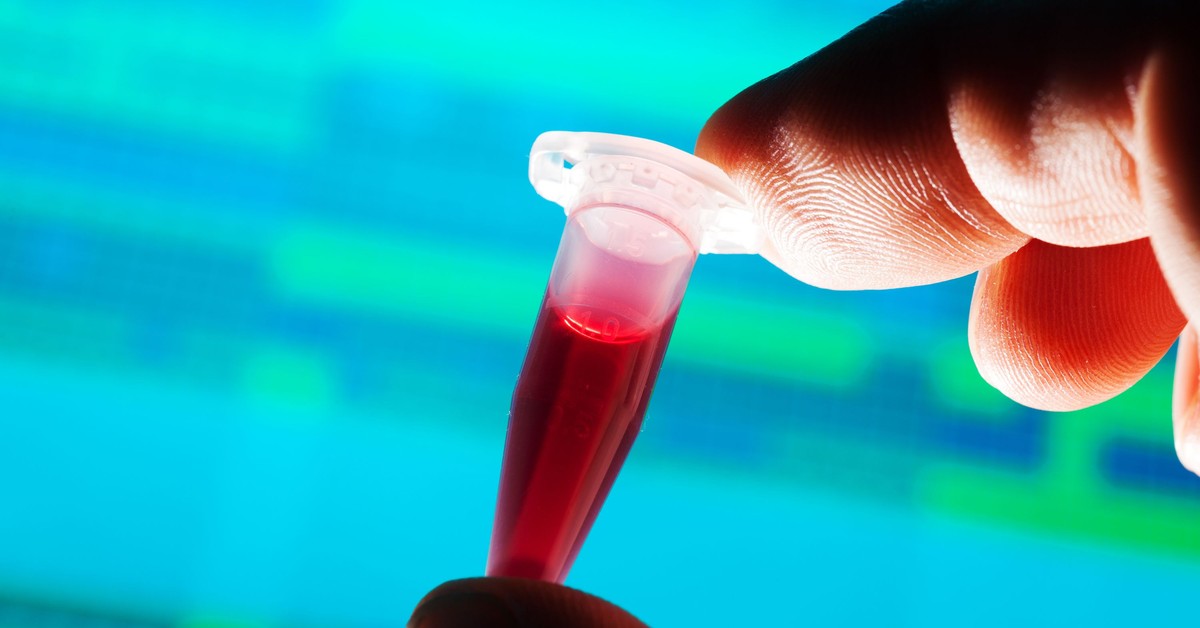 Oddasz krew, stracisz pieniądze. Rządzący dbają o krwiodawców, ale trzynastkę trzeba obniżyć