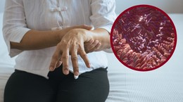 Revelado un nuevo elemento de la patología del Parkinson.  ¿La enfermedad cerebral comienza en el intestino?
