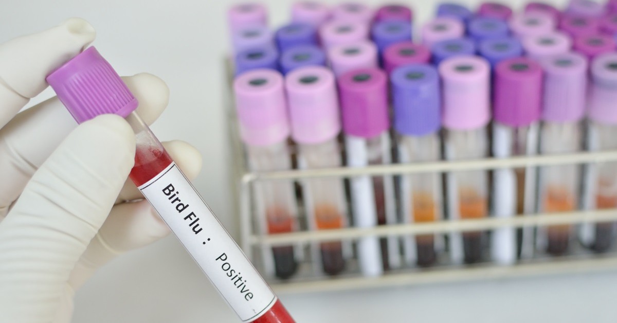 Pierwszy zgon na ptasią grypę H5N5. Naukowcy ostrzegają przed mutacją groźniejszą niż COVID-19