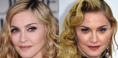 Madonna napompowała sobie twarz