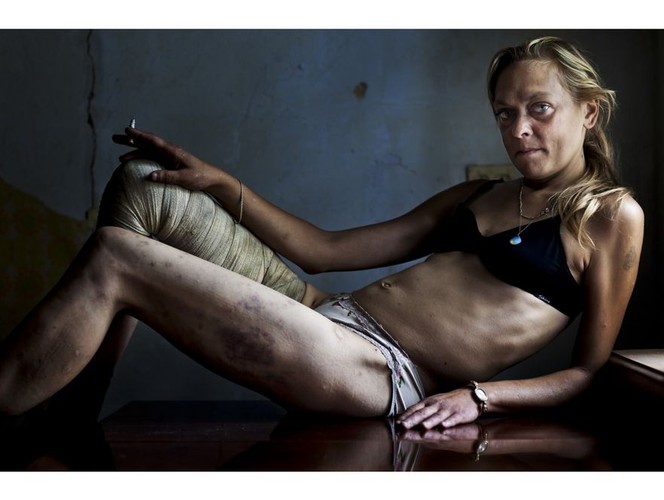Ukrainka Maria. Ciałem zarabia na narkotyki i utrzymanie siebie i swej 9-letniej córki - pierwsza nagroda w kategorii 'Współczesne problemy' - zdjęcie pojedyncze, autor: Brent Stirton