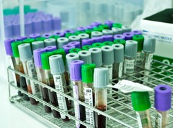 Badania genetyczne mogą uratować życie