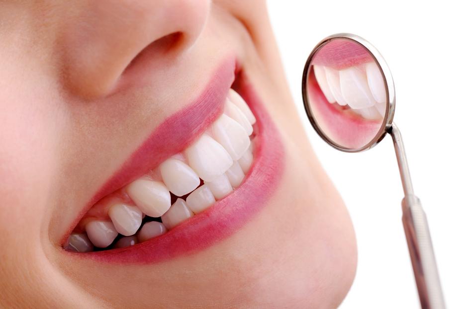 Elárulta a fogorvos a titkot: így lehetnek gyorsan fehér fogaid, és így távolíthatod el otthon egyszerűen a fogkövet  fotó: Getty Images