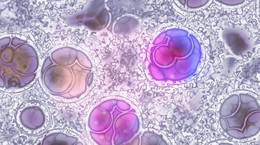 Polscy badacze: enzymy żaby mogą pomóc m.in. w terapii białaczek