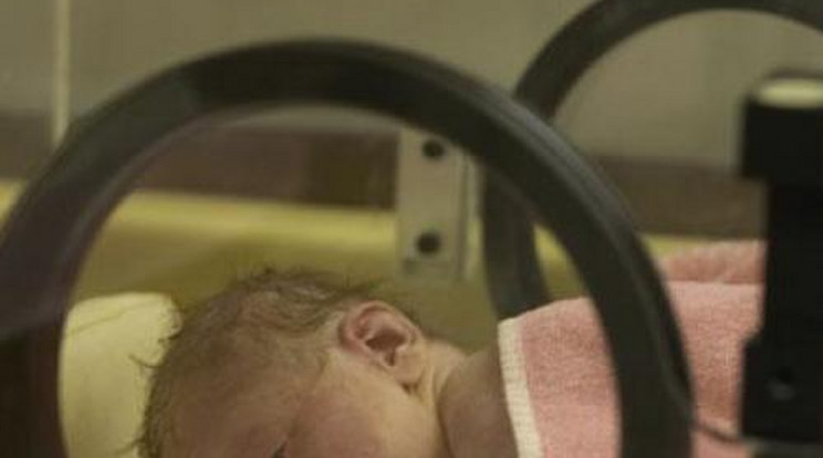 Horror! Halálra égett egy baba az inkubátorban