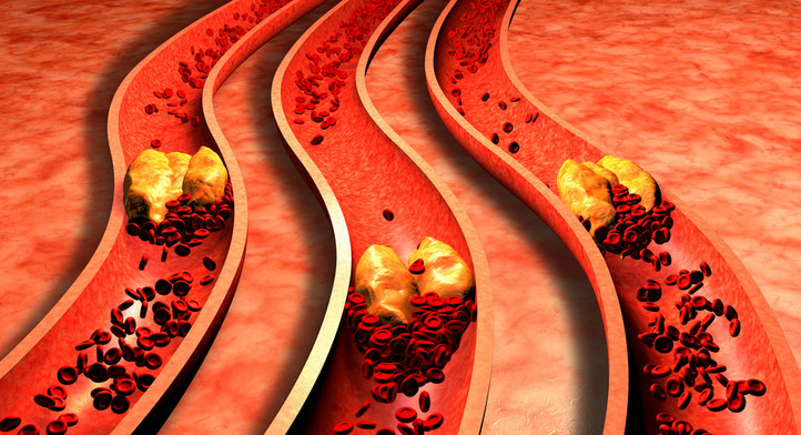 Od czego zacząć obniżanie cholesterolu? Praktyczne wskazówki od kardiologa i dietetyczki