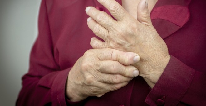A térdízület kopása (arthrosis) - A kéz kis ízületeinek deformáló ízületi kezelése