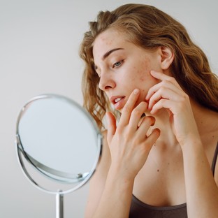 A „halál háromszöge” az arcon: miért figyelmeztetnek rá a bőrgyógyászok?