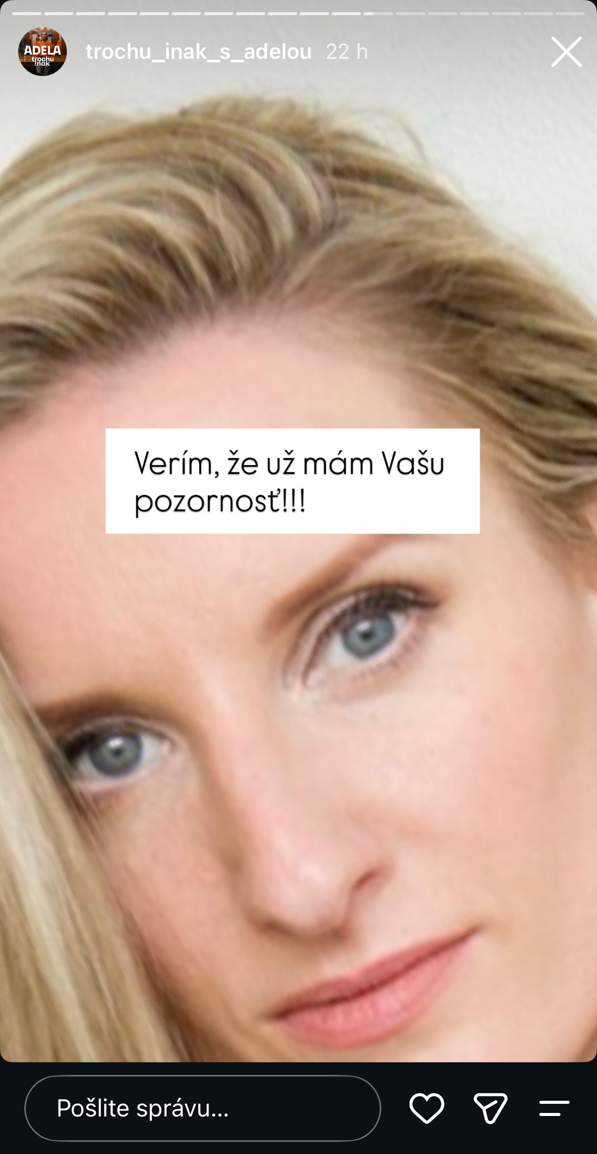 Adela Vinczeová zverejnila niekoľko nečakaných fotiek, aby zaujala sledovateľov a upozornila ich na voľné lístky na svoju šou.