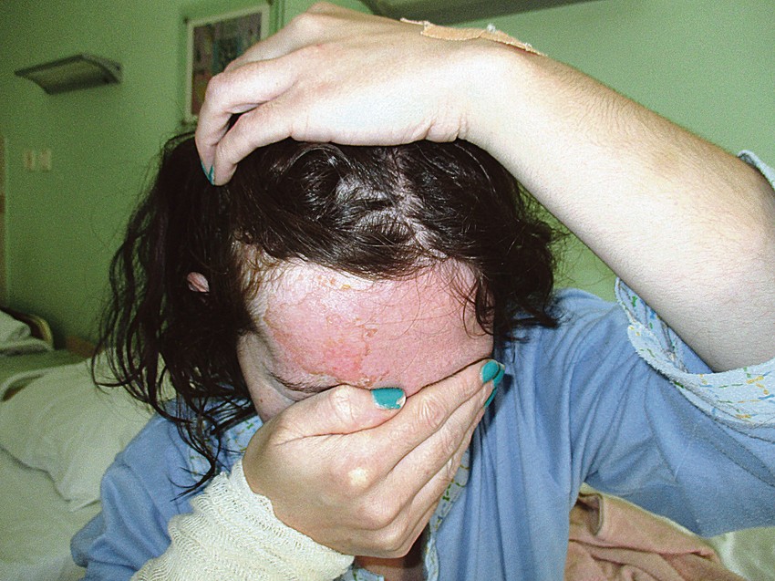 Mislila da je napad naručio bivši muž