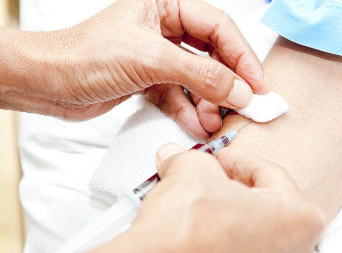 Wykonaj badania laboratoryjne