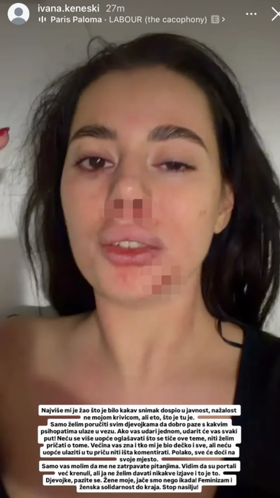 Jezive fotografije pretučene bivše rijaliti učesnice: "Devojke, pazite se"
