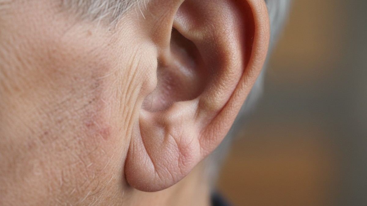 Frankov znak je duboka bora koja se formira na jednoj ili obe ušne resice