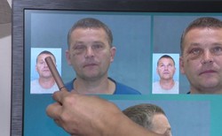 "Naprawdę wielkie szczęście". Udana rekonstrukcja twarzy przy użyciu kości wydrukowanych w 3D