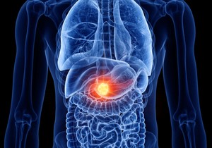ilustracija za rak jetre