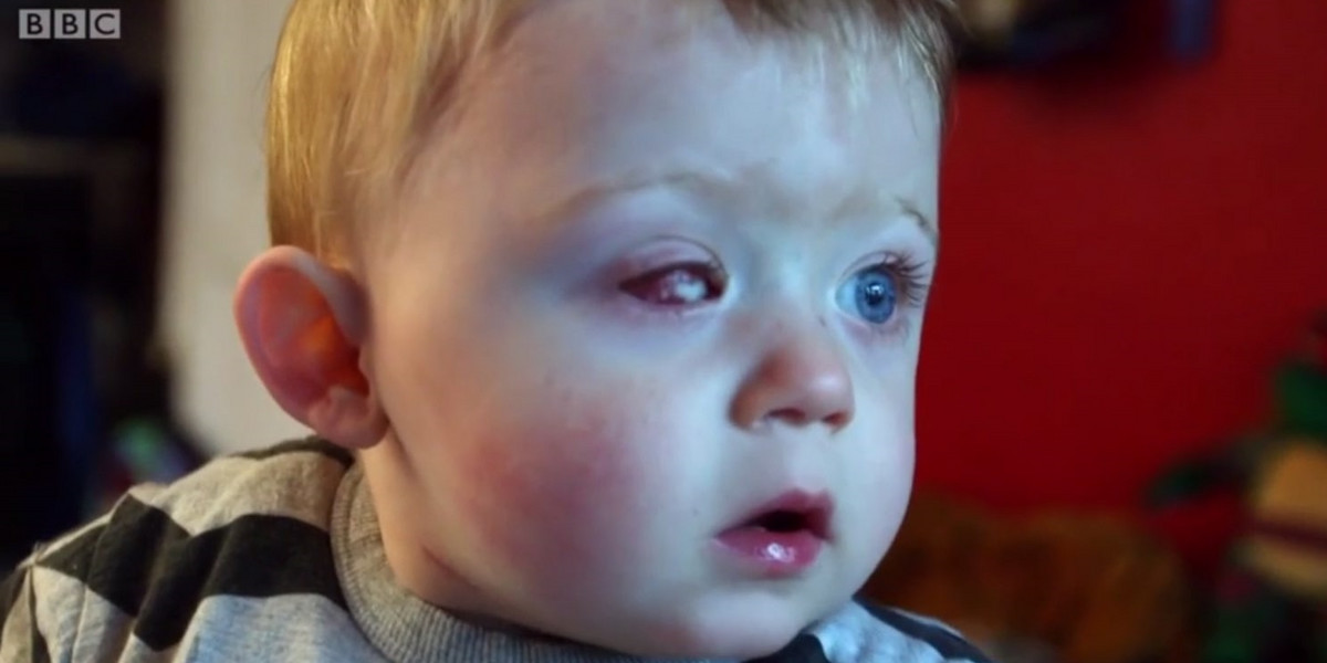 Oskar stracił oko po tym jak uderzył w niego dron sąsiada