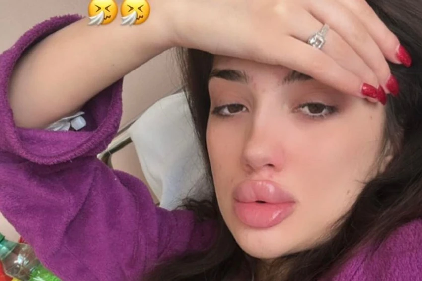 Sara 4 meseca nakon porođaja završila u invalidskim kolicima: "Bojim se, nepokretna sam"