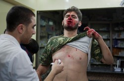 Trwa damatyczna walka o życie. Wstrząsające ZDJĘCIA z Syrii