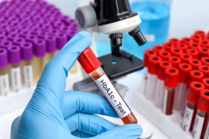 HbA1c - tudja meg, mi ez és miért nézik folyton cukorbetegség esetén