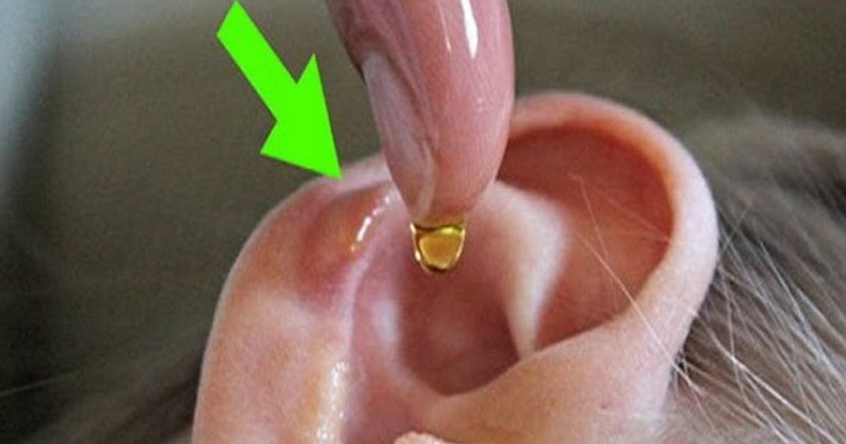 Ocet i alkohol - zaaplikowany do ucha usuwa woskowinę uszną - Kobieta
