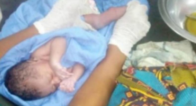 A newborn baby trapped on a barbed wire after being thrown from a female hostel of the Federal Polytechnic, Oko in Anambra, has been rescued. [LIB]