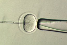 Nowa metoda in vitro - dziecko trojga rodziców uniknęło śmiertelnej choroby