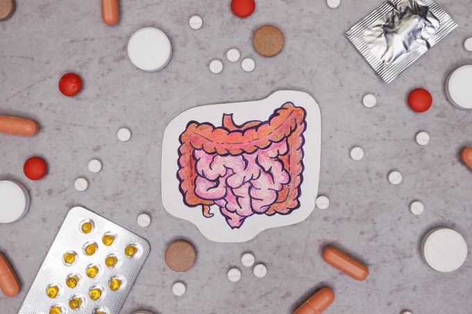 Az antibiotikumok szedése növelheti a vastagbélrák esélyét?