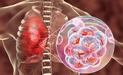 Legionelloza - choroba brudnych instalacji i zaniedbanych fontann. To trzeba wiedzieć!