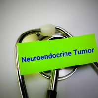 Neuroendokrin daganatok