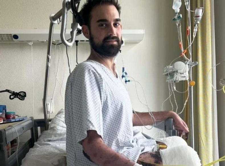 Ostao bez ruku i nogu