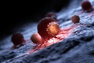 Illustration of white blood cells attacking a cancer cell