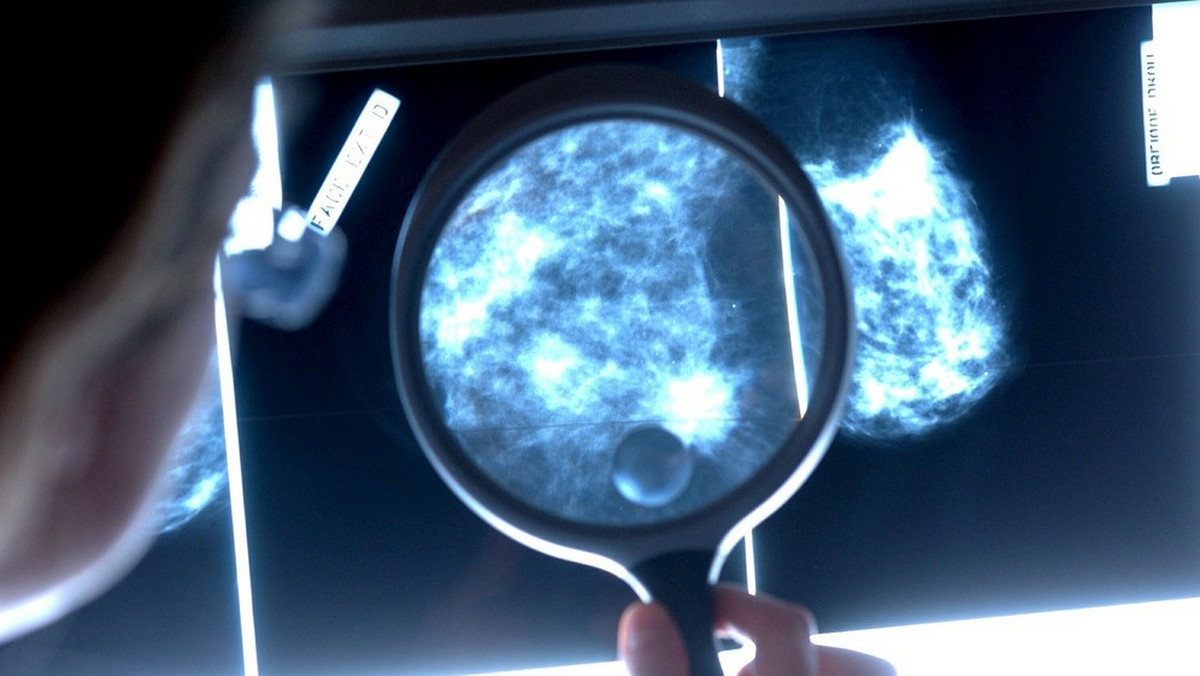 Centrum Chorób Piersi, tzw. breast unit, otwarto wczoraj w Dolnośląskim Centrum Onkologii we Wrocławiu. Placówka za 43 mln zł rocznie ma przyjąć nawet 1 tys. pacjentek. Do kompleksowego leczenia raka piersi wyposażono ją w najnowocześniejszy w Polsce sprzęt.