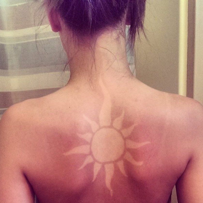 Sunburn Art