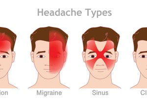 Vrste glavobolje u odnosu na mesto bola 