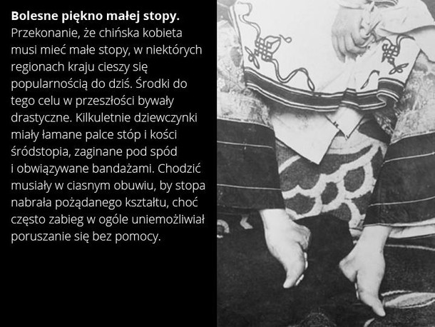 kobiety historia