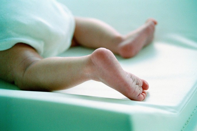 Pre otpusta iz porodilišta roditelji treba da dobiju objašnjenja uzroka žutice